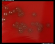 alpha-hemolysis on agar
